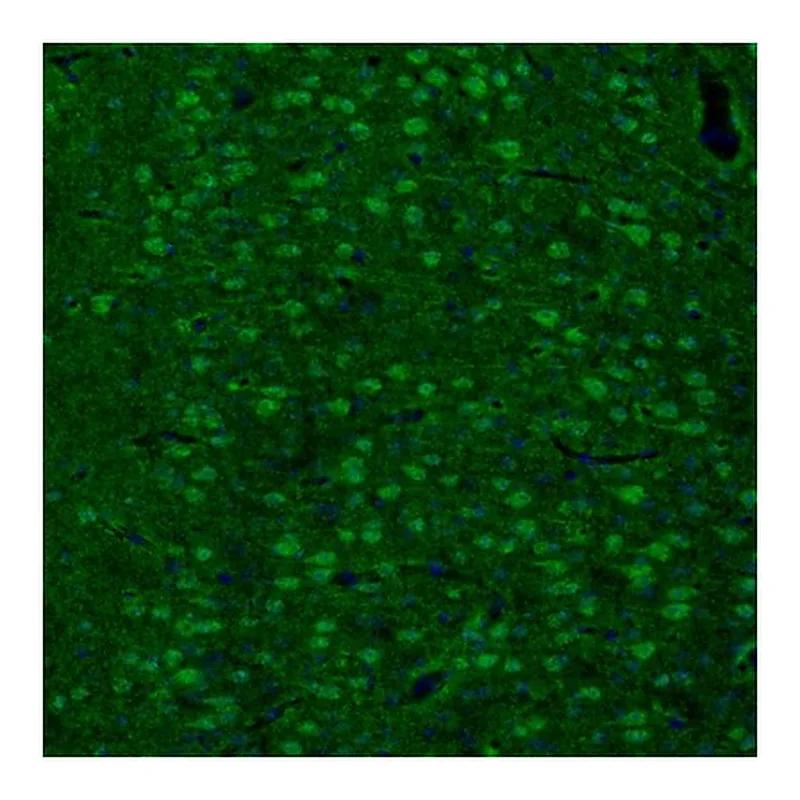 Atlas Antibodies Anti-ARHGAP1 Antibody
