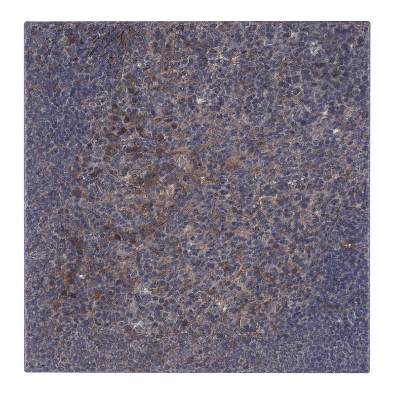Atlas Antibodies Anti-ARHGAP11A Antibody