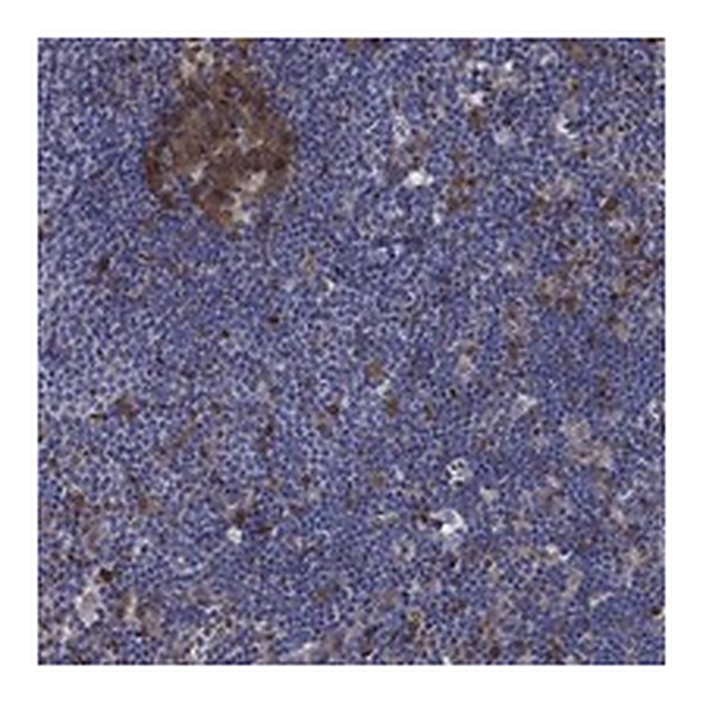 Atlas Antibodies Anti-ARHGAP11A Antibody