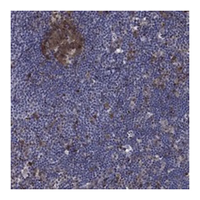 Atlas Antibodies Anti-ARHGAP11A Antibody