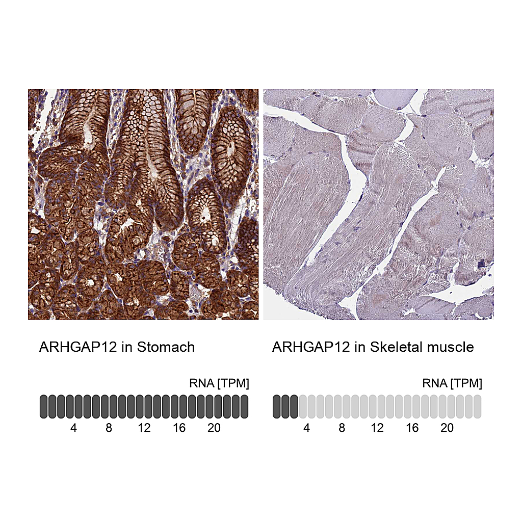 Atlas Antibodies Anti-ARHGAP12 Antibody