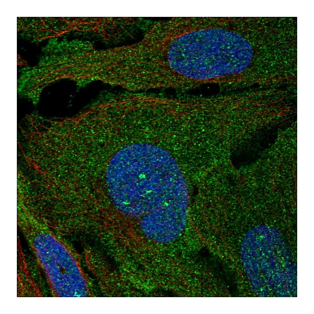 Atlas Antibodies Anti-ARHGAP19 Antibody