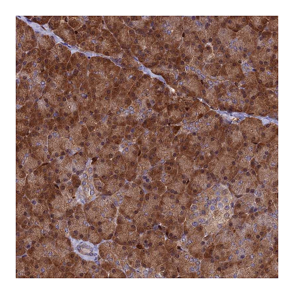 Atlas Antibodies Anti-ARHGAP18 Antibody