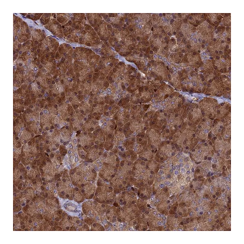 Atlas Antibodies Anti-ARHGAP18 Antibody