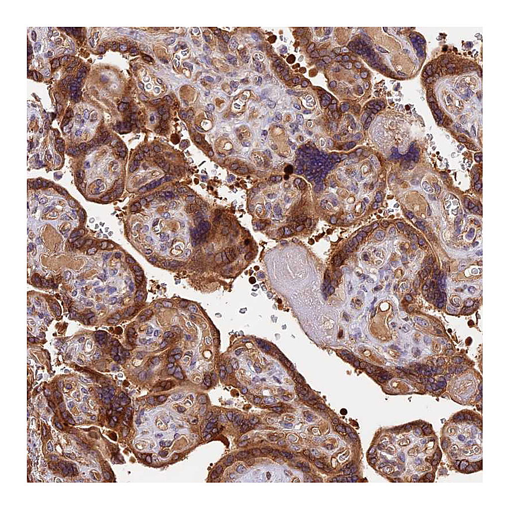 Atlas Antibodies Anti-ARHGAP17 Antibody
