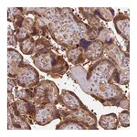 Atlas Antibodies Anti-ARHGAP17 Antibody