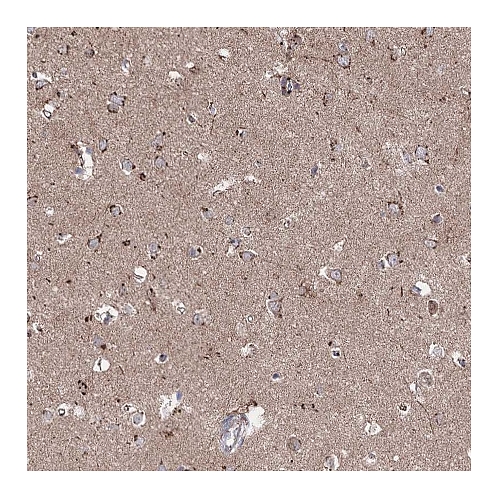 Atlas Antibodies Anti-ARHGAP20 Antibody