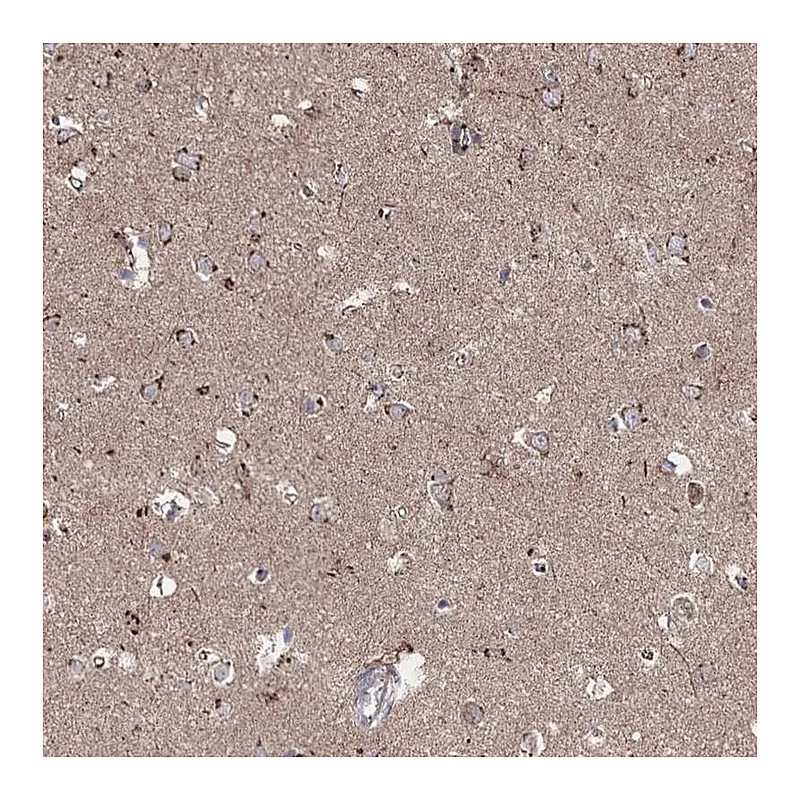 Atlas Antibodies Anti-ARHGAP20 Antibody