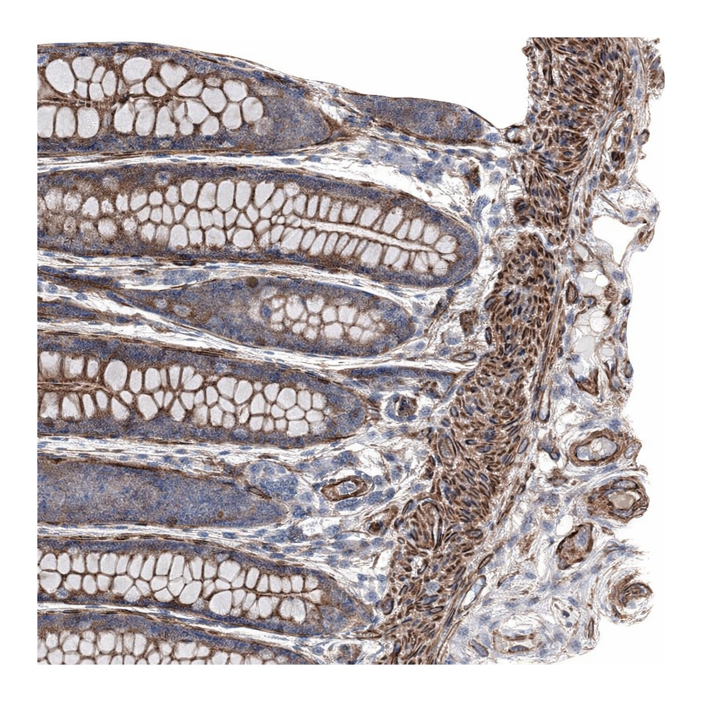 Atlas Antibodies Anti-ARHGAP20 Antibody
