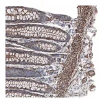 Atlas Antibodies Anti-ARHGAP20 Antibody