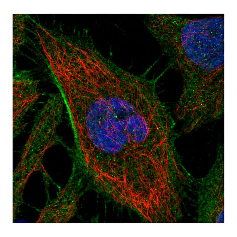 Atlas Antibodies Anti-ARHGAP21 Antibody