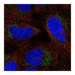 Atlas Antibodies Anti-ARHGAP20 Antibody