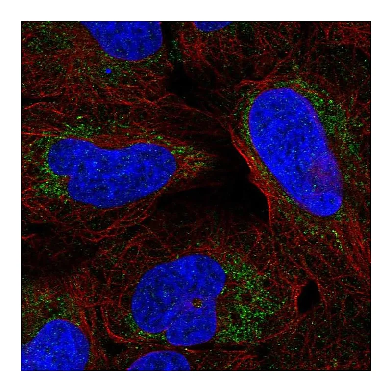 Atlas Antibodies Anti-ARHGAP20 Antibody