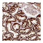 Atlas Antibodies Anti-ARHGAP22 Antibody