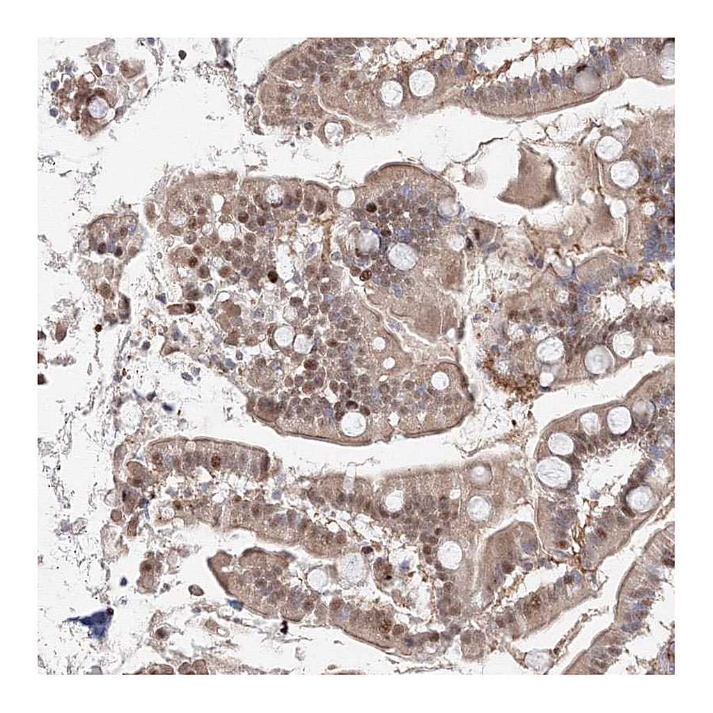 Atlas Antibodies Anti-ARHGAP21 Antibody