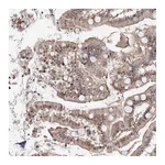 Atlas Antibodies Anti-ARHGAP21 Antibody