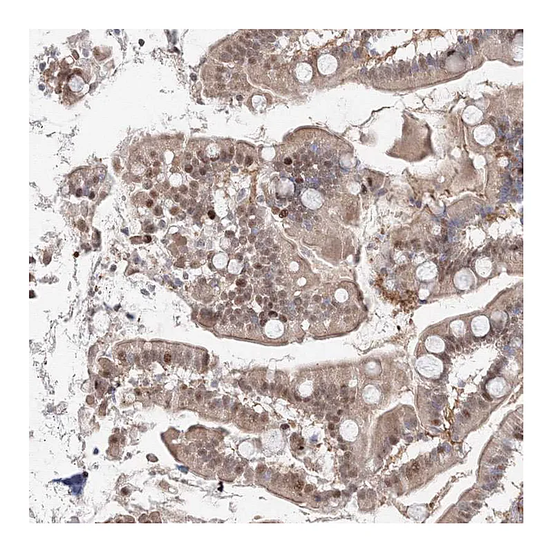 Atlas Antibodies Anti-ARHGAP21 Antibody