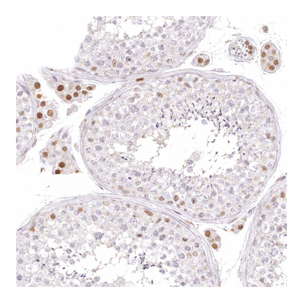Atlas Antibodies Anti-ARHGAP22 Antibody