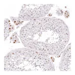 Atlas Antibodies Anti-ARHGAP22 Antibody