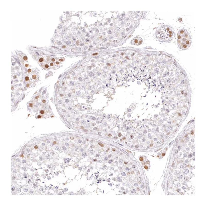 Atlas Antibodies Anti-ARHGAP22 Antibody