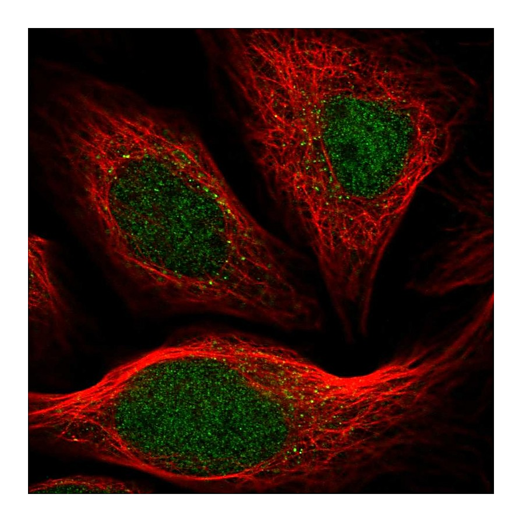 Atlas Antibodies Anti-ARHGAP23 Antibody