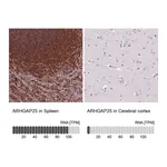 Atlas Antibodies Anti-ARHGAP25 Antibody