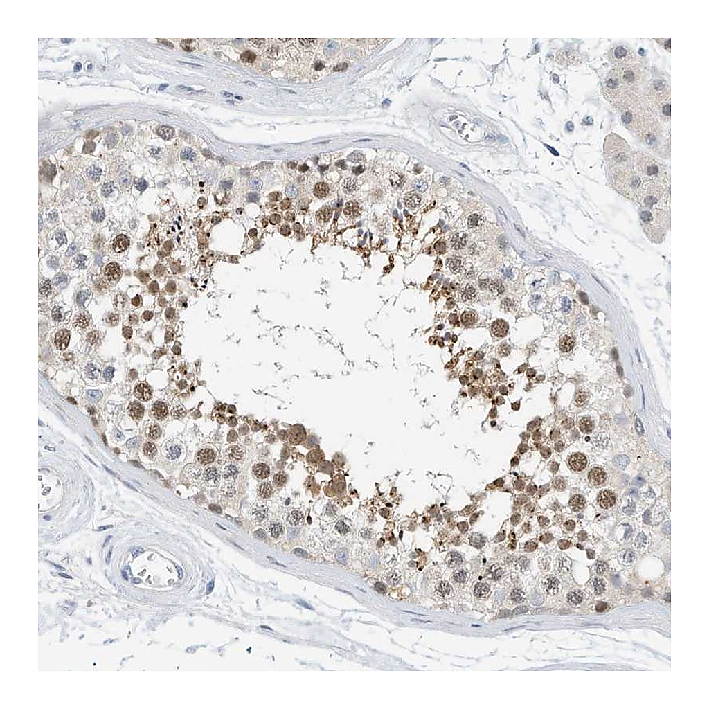 Atlas Antibodies Anti-ARHGAP28 Antibody
