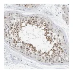 Atlas Antibodies Anti-ARHGAP28 Antibody