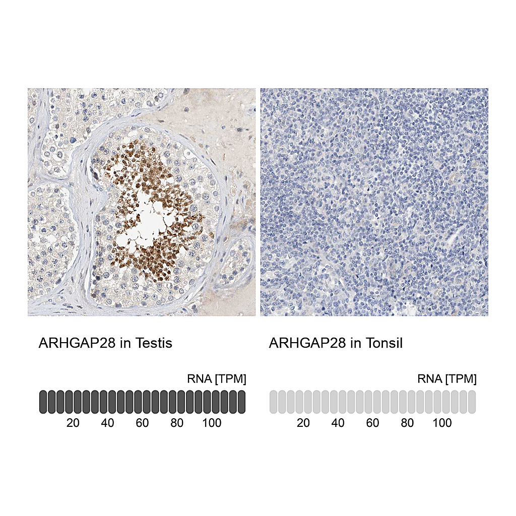 Atlas Antibodies Anti-ARHGAP28 Antibody