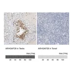 Atlas Antibodies Anti-ARHGAP28 Antibody