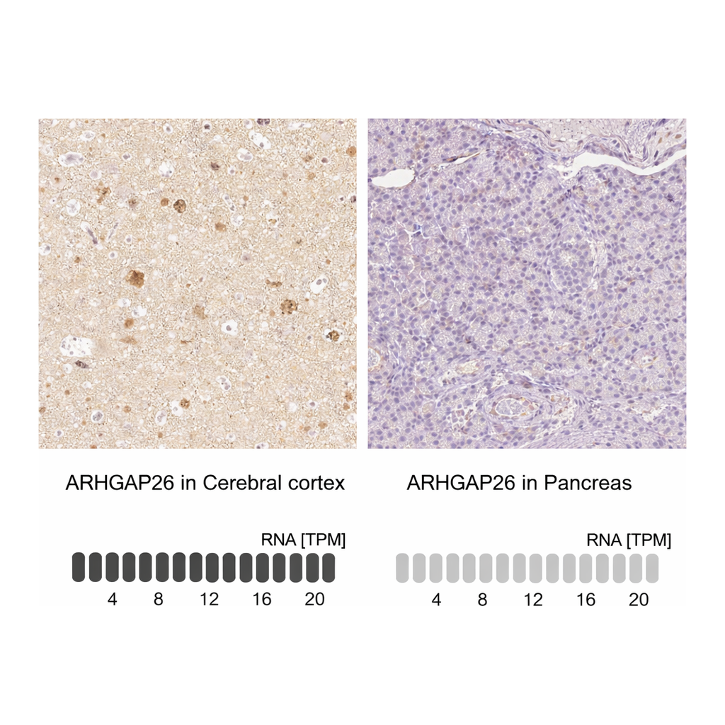 Atlas Antibodies Anti-ARHGAP26 Antibody
