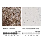 Atlas Antibodies Anti-ARHGAP25 Antibody