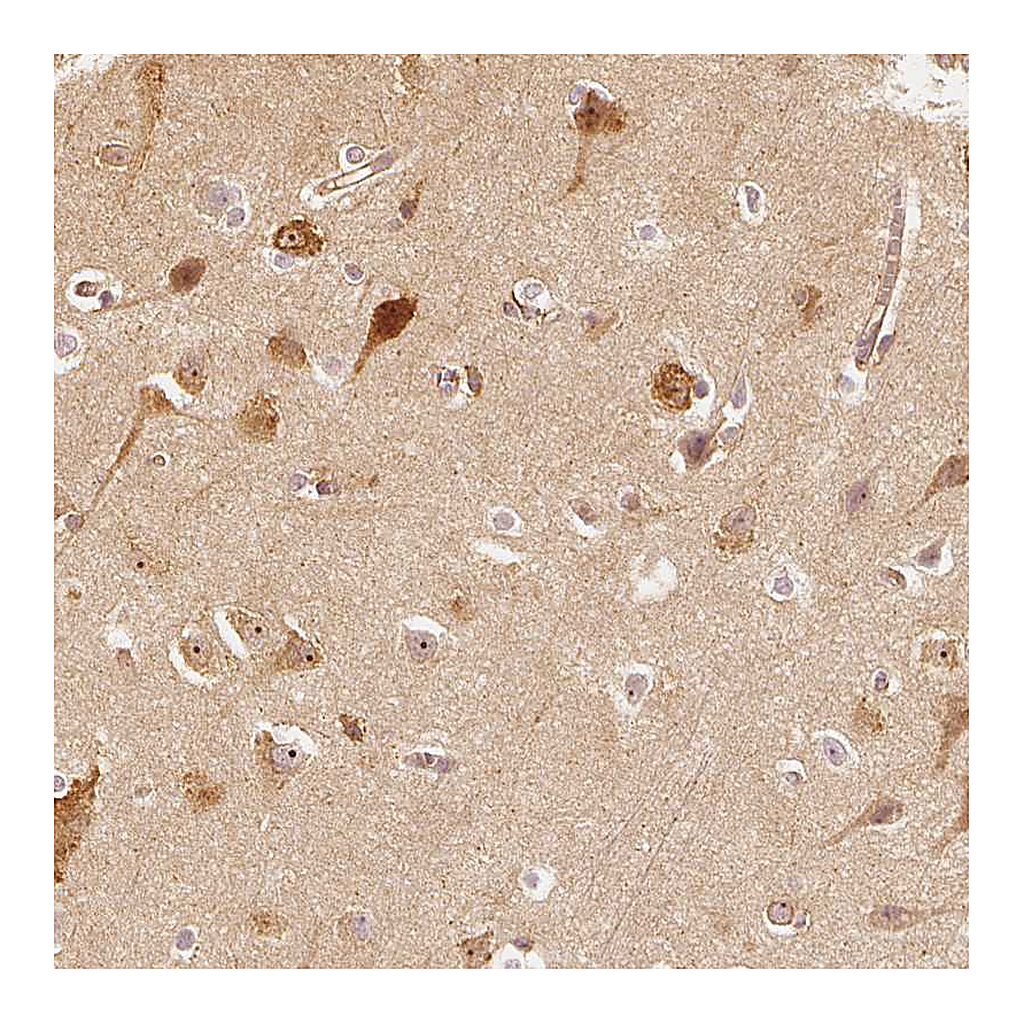 Atlas Antibodies Anti-ARHGAP26 Antibody