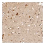Atlas Antibodies Anti-ARHGAP26 Antibody