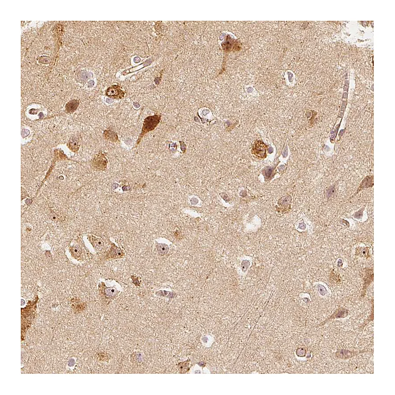 Atlas Antibodies Anti-ARHGAP26 Antibody