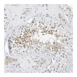 Atlas Antibodies Anti-ARHGAP28 Antibody