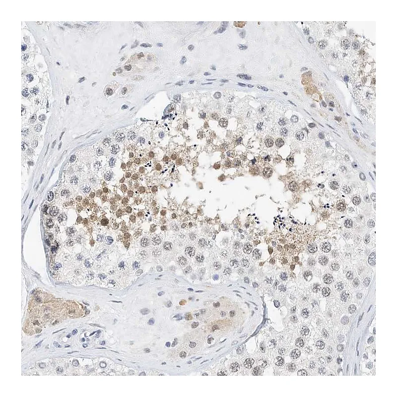 Atlas Antibodies Anti-ARHGAP28 Antibody