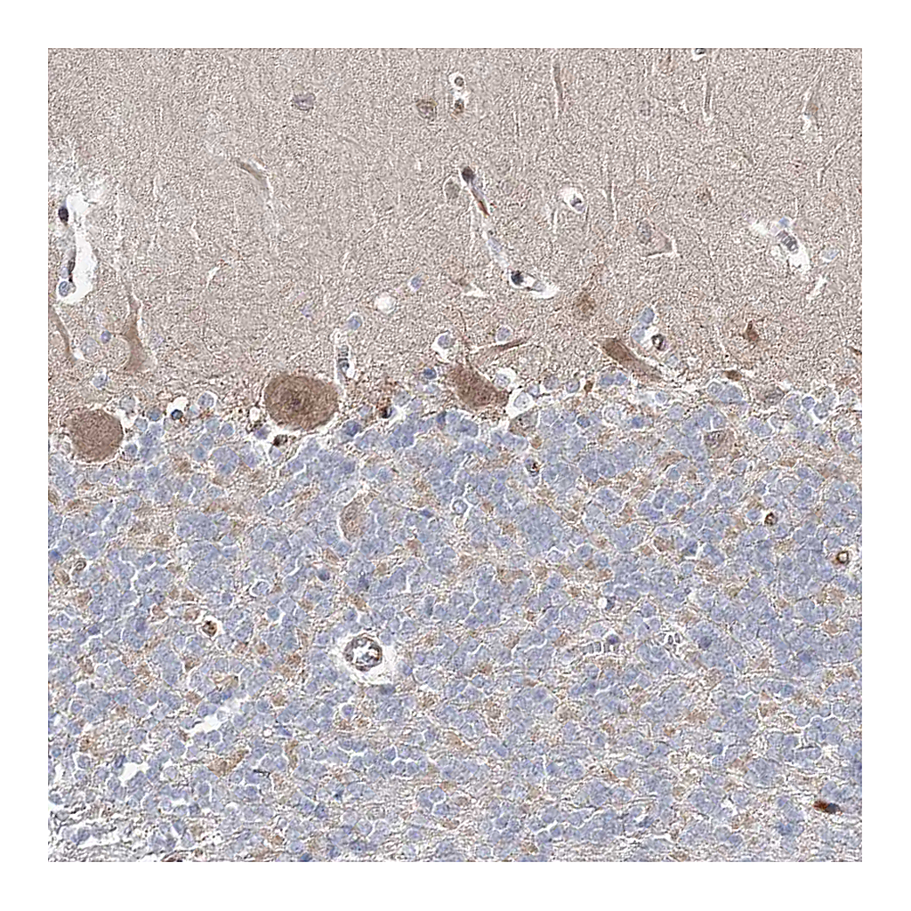 Atlas Antibodies Anti-ARHGAP32 Antibody