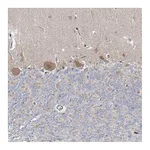 Atlas Antibodies Anti-ARHGAP32 Antibody
