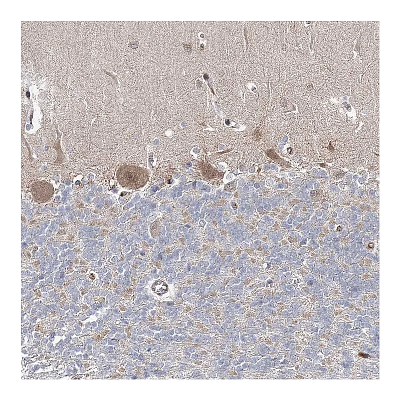 Atlas Antibodies Anti-ARHGAP32 Antibody
