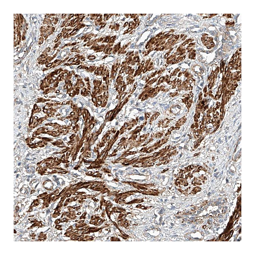 Atlas Antibodies Anti-ARHGAP33 Antibody