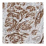 Atlas Antibodies Anti-ARHGAP33 Antibody