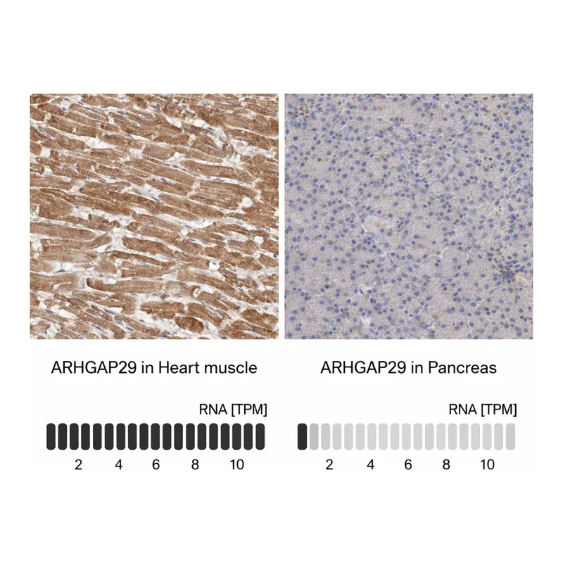 Atlas Antibodies Anti-ARHGAP29 Antibody