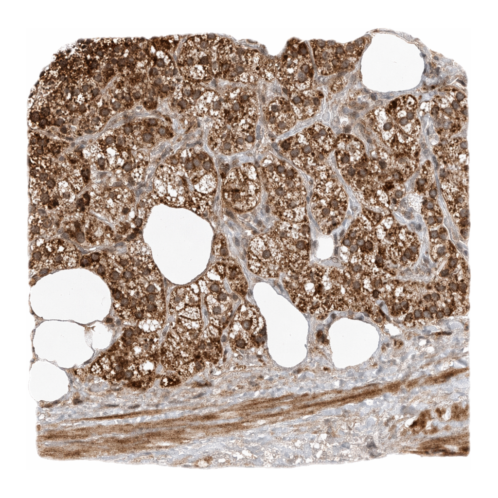 Atlas Antibodies Anti-ARHGAP33 Antibody