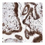 Atlas Antibodies Anti-ARHGAP31 Antibody