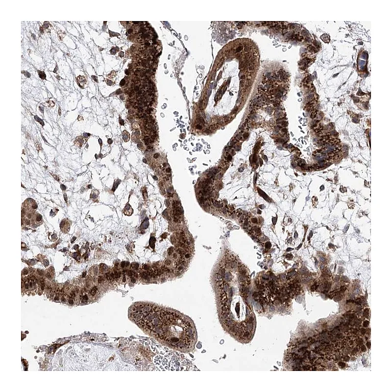 Atlas Antibodies Anti-ARHGAP31 Antibody