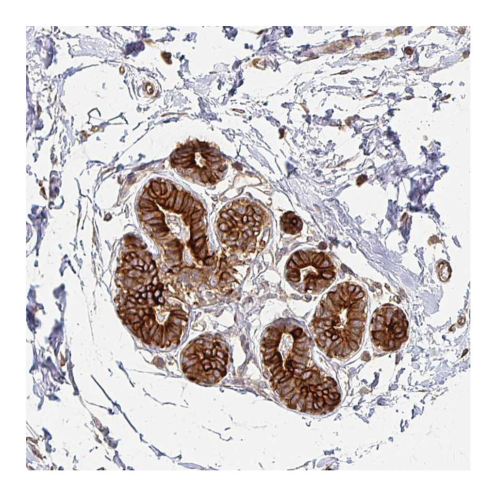 Atlas Antibodies Anti-ARHGAP35 Antibody