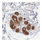 Atlas Antibodies Anti-ARHGAP35 Antibody