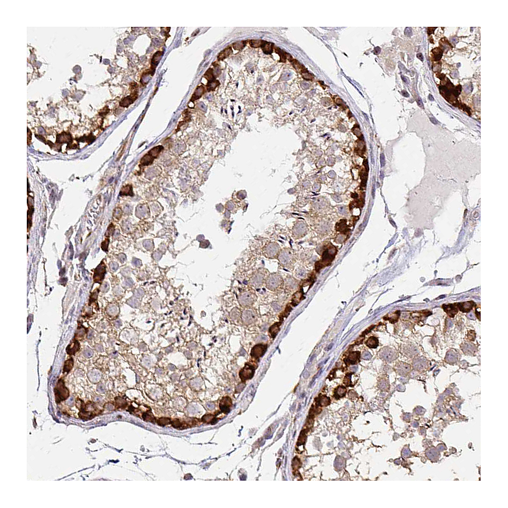 Atlas Antibodies Anti-ARHGAP35 Antibody