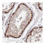 Atlas Antibodies Anti-ARHGAP35 Antibody